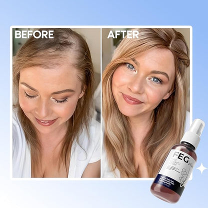 💆 Pack of 2 FEG Hair Growth Spray + Derma Roller | Hair Care Kit for Men & Women ✨