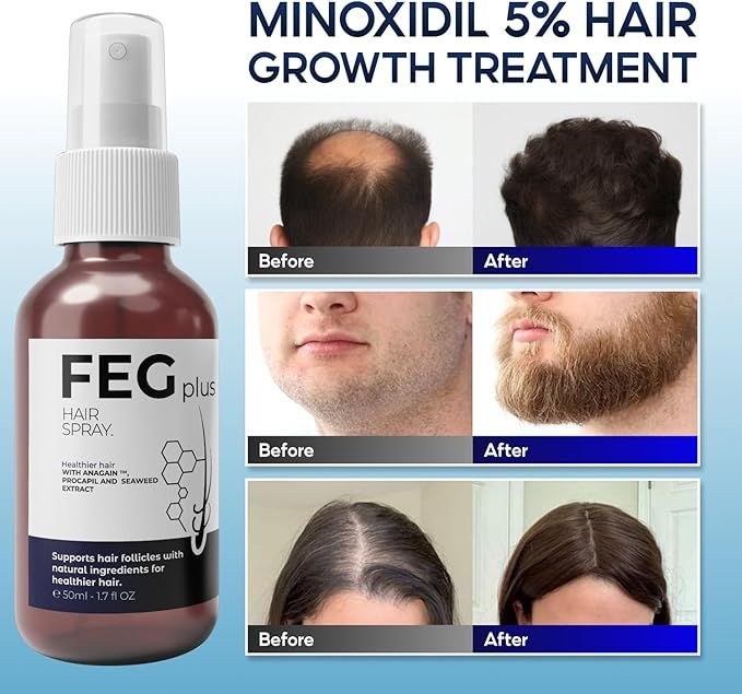 FEG Plus Hair Growth Spray